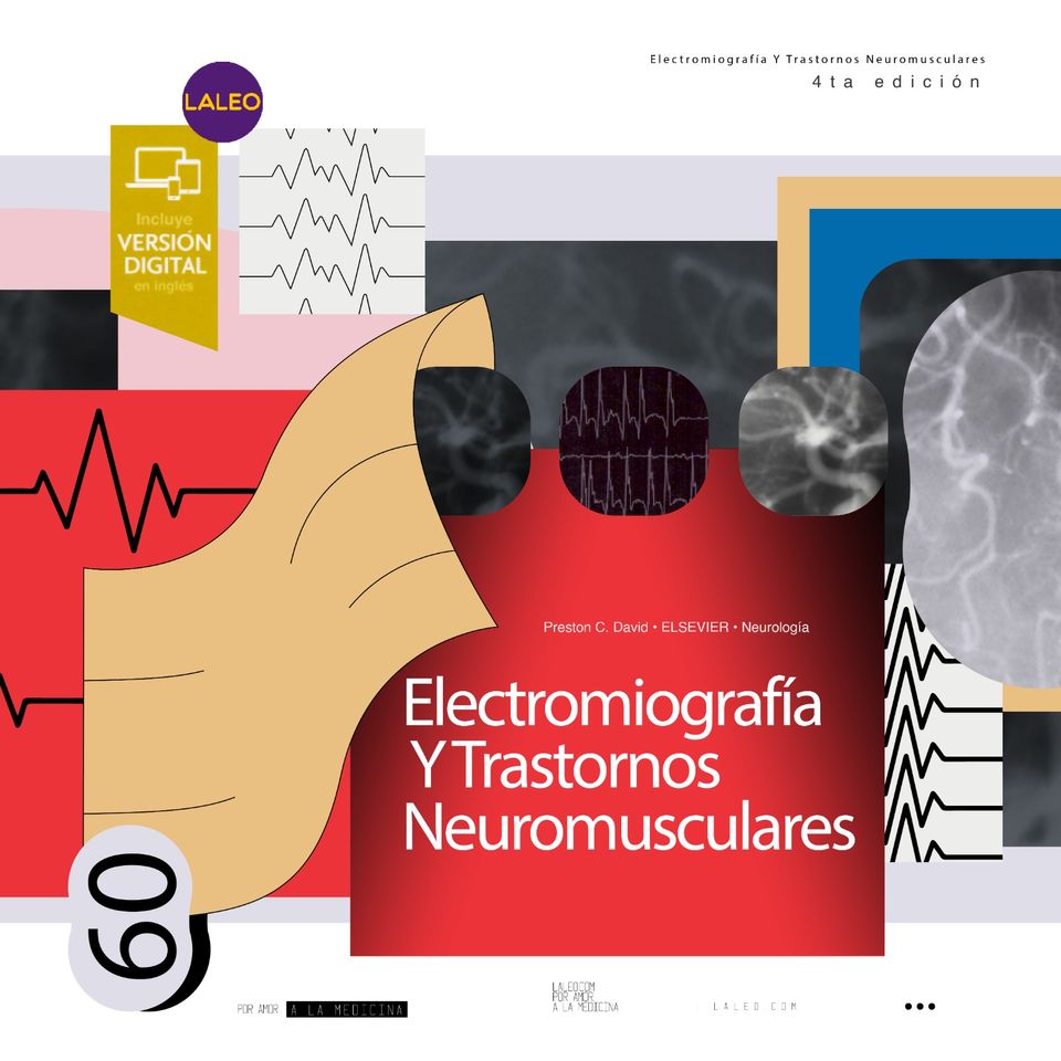 Electromiografía y trastornos neuromusculares
